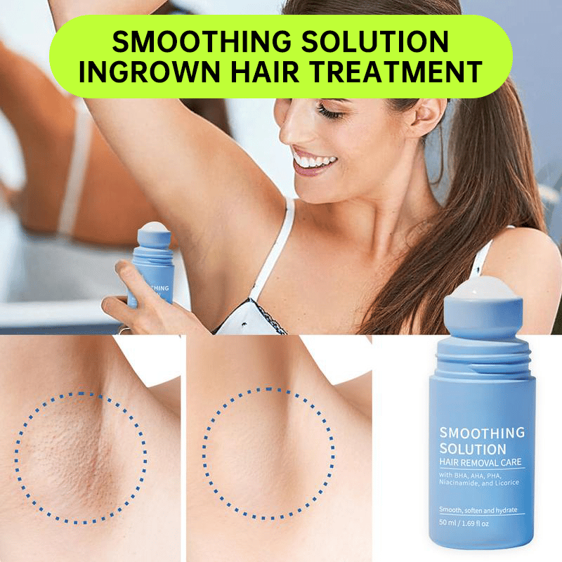 Smoothing Solution Ingrown Hair Treatment